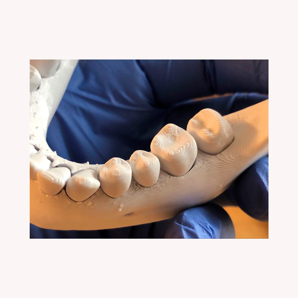 Modelo de dientes en mandíbula